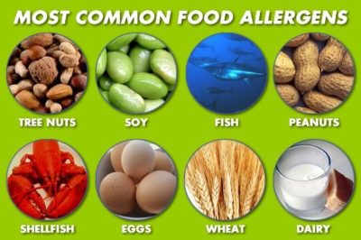 Food Allergies: What To Eat When You Can't Eat Anything